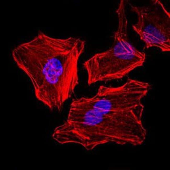 Cytokeratin 5 Monoclonal Antibody (2C2)
