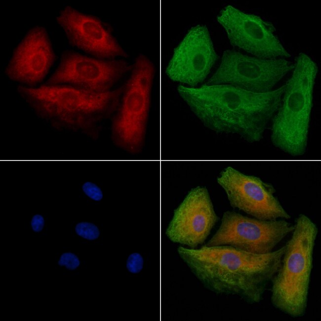 MARCH1 Polyclonal Antibody
