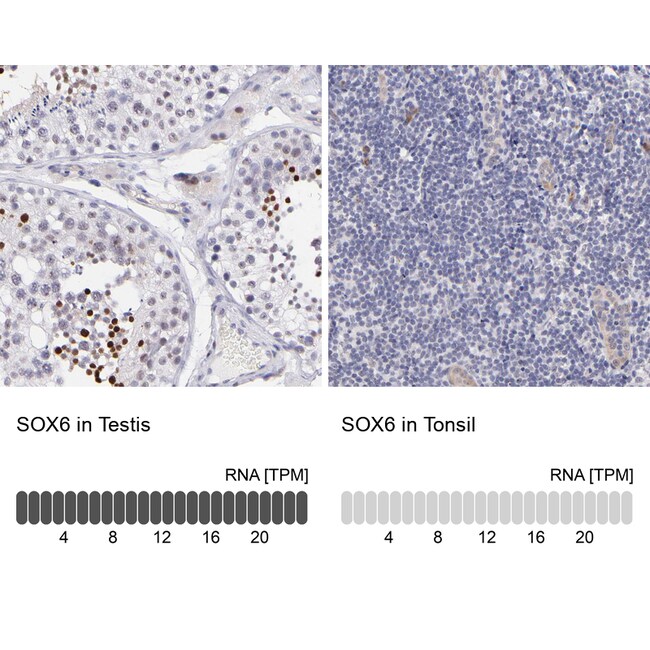 SOX6 Polyclonal Antibody