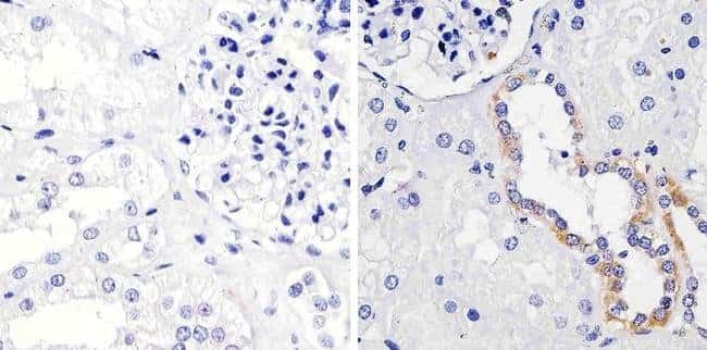 FGFR1 Monoclonal Antibody (VBS-7)