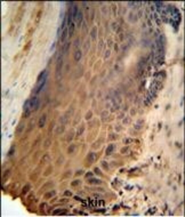 GFPT2 Polyclonal Antibody
