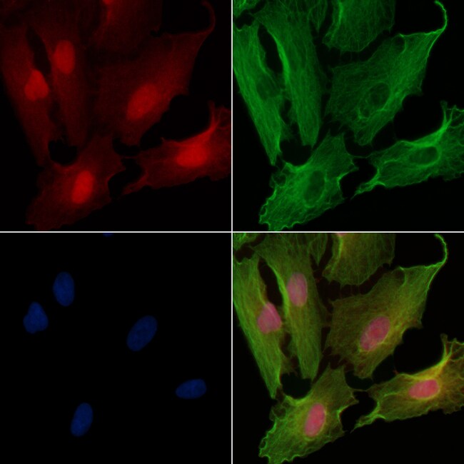 BOK Polyclonal Antibody