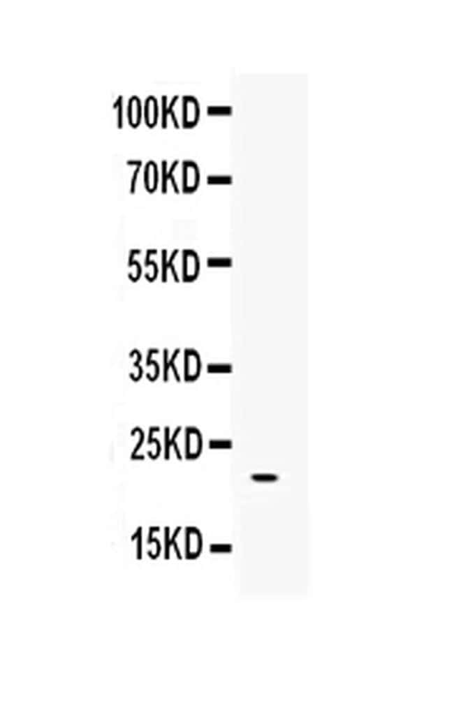 BMP4 Polyclonal Antibody