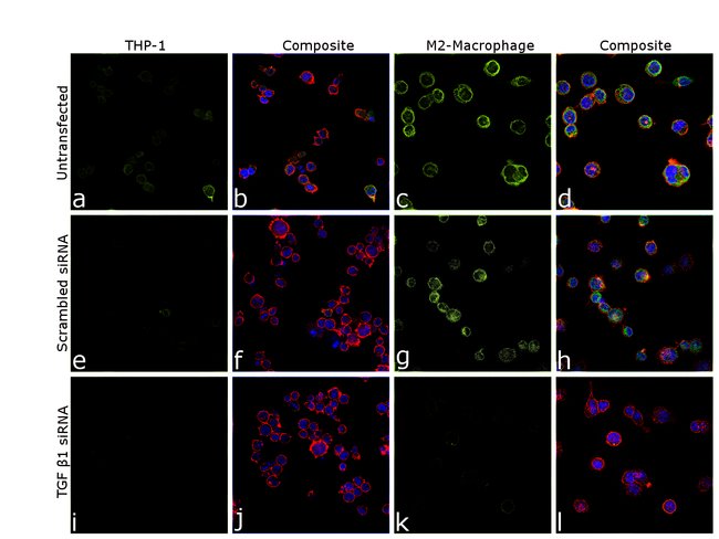 TGF beta-1 Monoclonal Antibody (TB21)