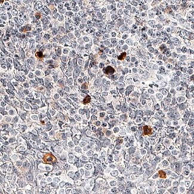 NLRP3 Monoclonal Antibody (768319)