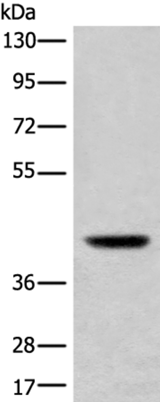 USP12 Polyclonal Antibody