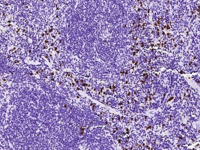 S100A8 Polyclonal Antibody