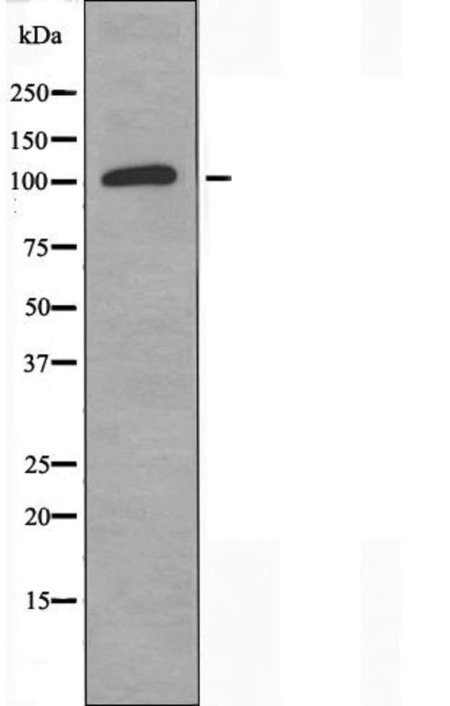ST18 Polyclonal Antibody