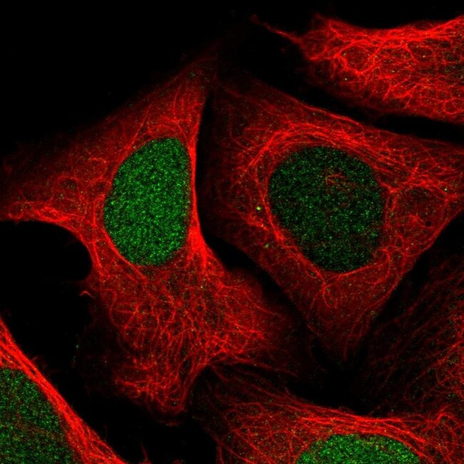 UPP1 Polyclonal Antibody