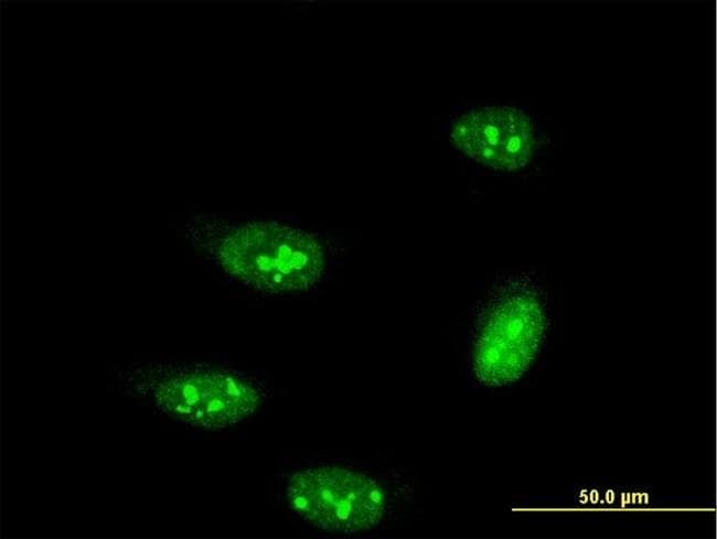 PRPK Monoclonal Antibody (3A1)