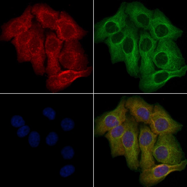 OR10A6 Polyclonal Antibody