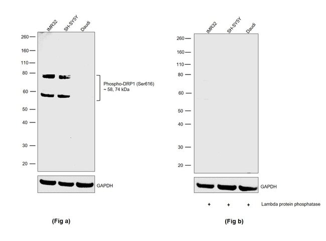 Phospho-DRP1 (Ser616) Polyclonal Antibody
