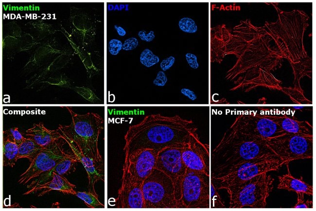 Vimentin Monoclonal Antibody (RV202)