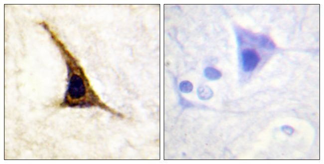 Phospho-beta-2 Adrenergic Receptor (Ser355, Ser356) Polyclonal Antibody
