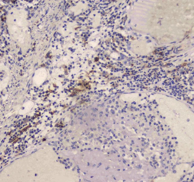 DC-SIGN (CD209) Polyclonal Antibody