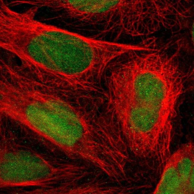 LTBP2 Polyclonal Antibody