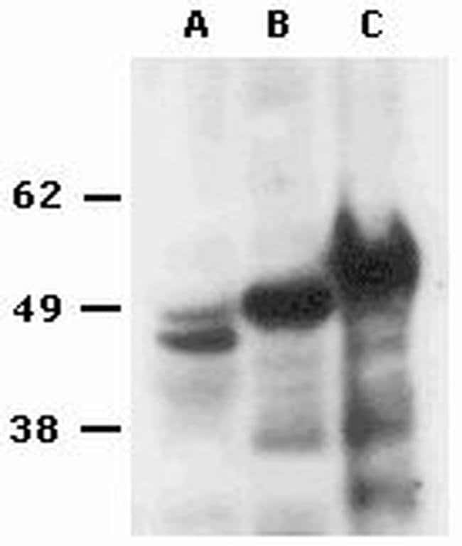 FOXP3 Monoclonal Antibody (eBio7979 (221D/D3)), eBioscience