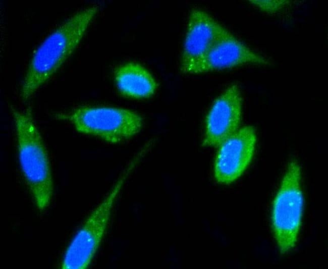 FAK Recombinant Rabbit Monoclonal Antibody (SR46-04)