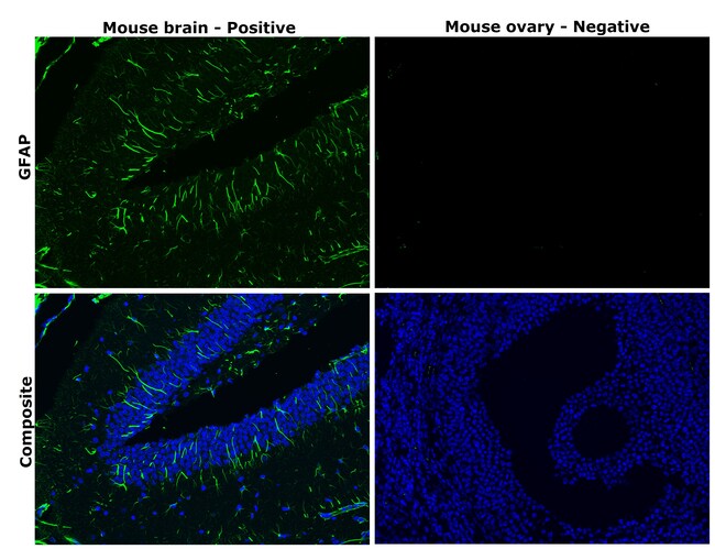 GFAP Monoclonal Antibody (GA5), Alexa Fluor 488, eBioscience