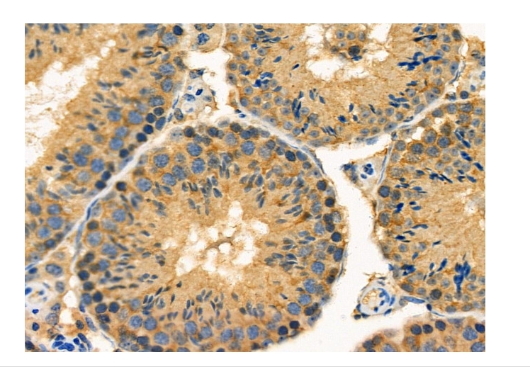 EDG4 Polyclonal Antibody