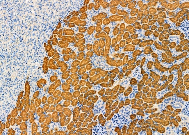 Aldolase B Polyclonal Antibody
