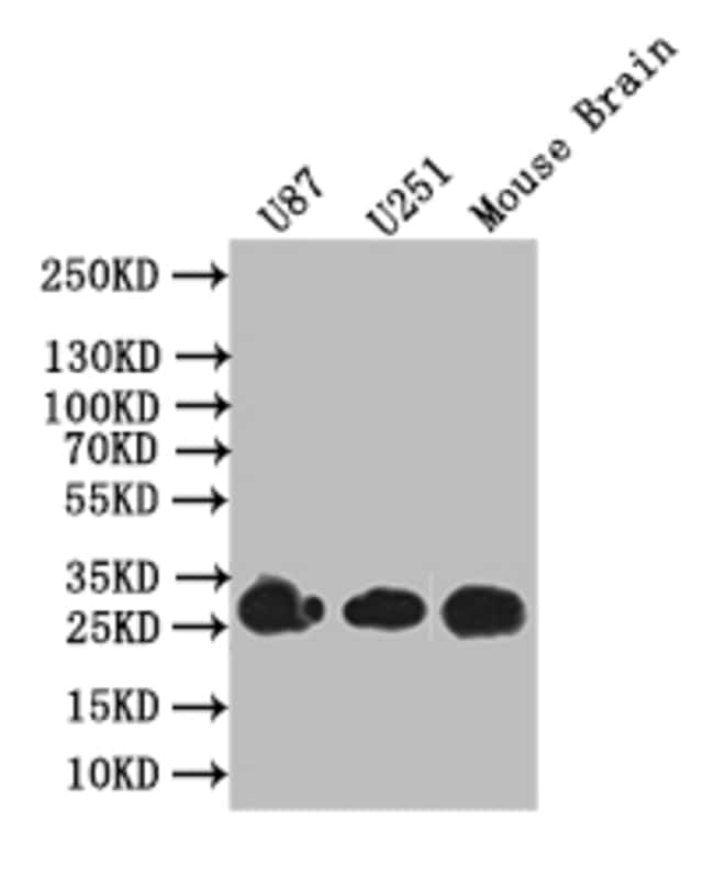 BDNF Recombinant Rabbit Monoclonal Antibody (1A1)