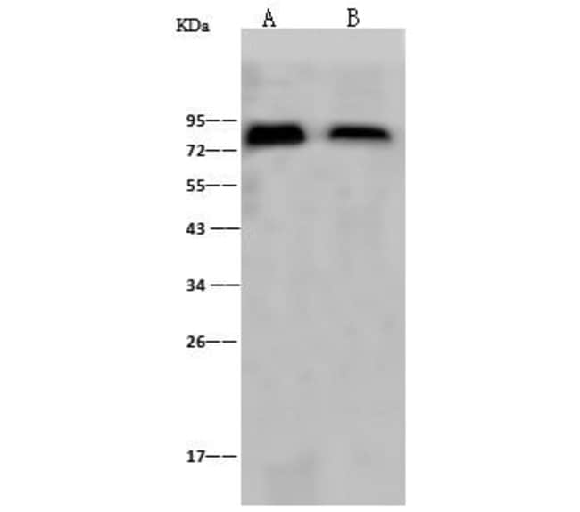 Influenza A H1N1 HA (A/Puerto Rico/8/34) Polyclonal Antibody