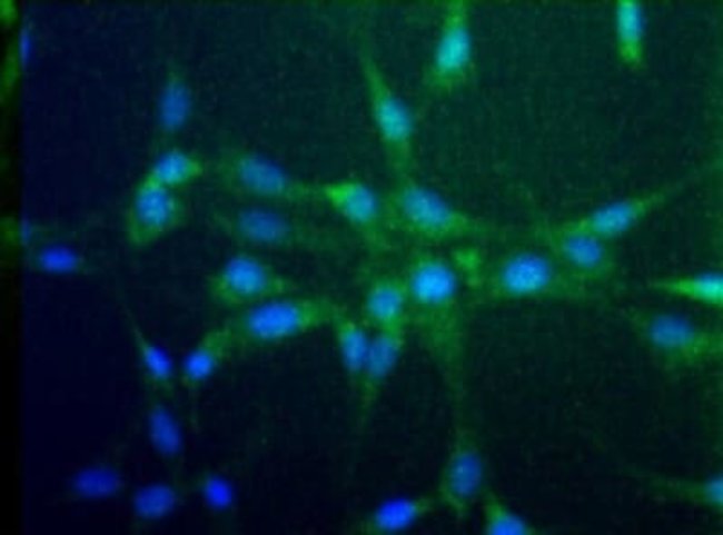 CCR2 Polyclonal Antibody