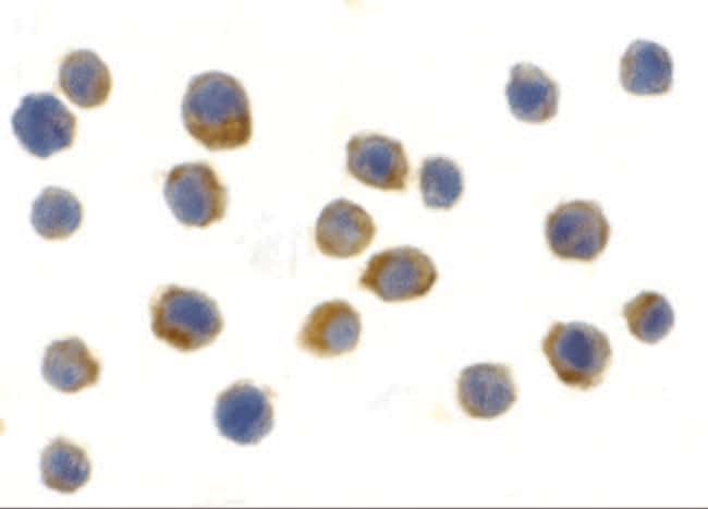 TLR9 Polyclonal Antibody