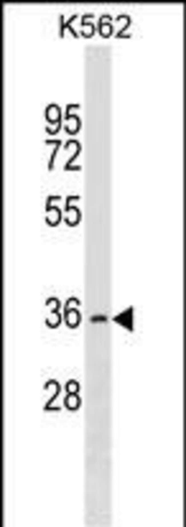 OR2AG2 Polyclonal Antibody