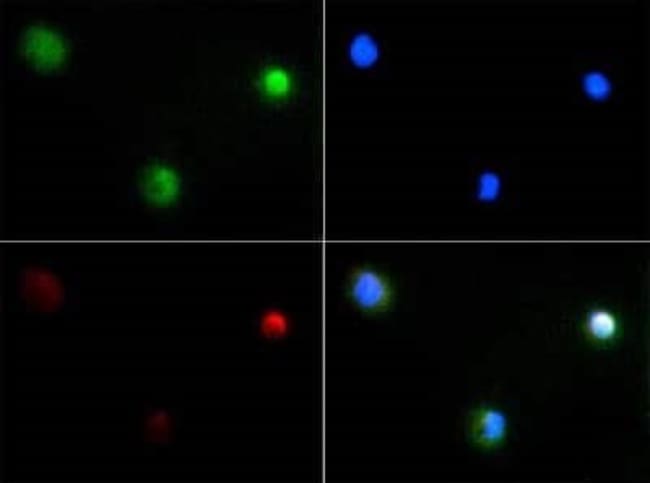 PIEZO2 Polyclonal Antibody