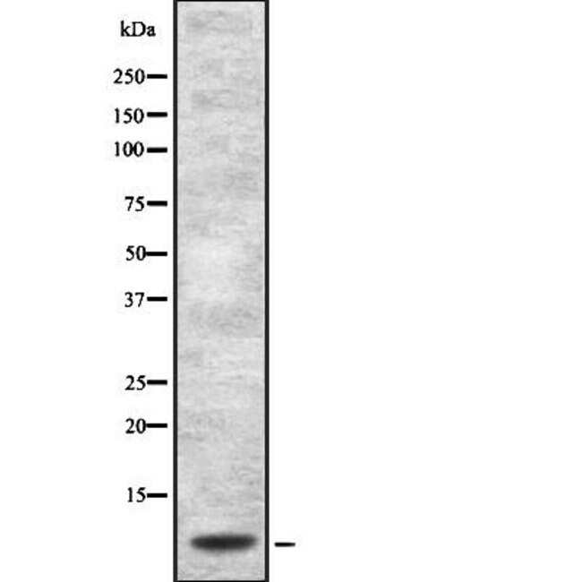 DEFA1 Polyclonal Antibody