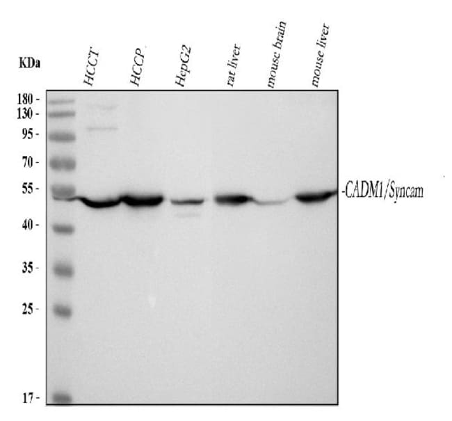 CADM1 Polyclonal Antibody