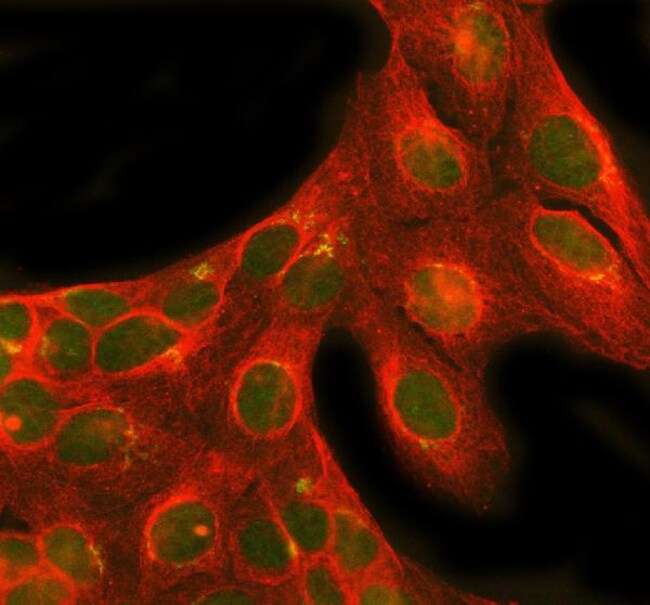 NRG1 Polyclonal Antibody