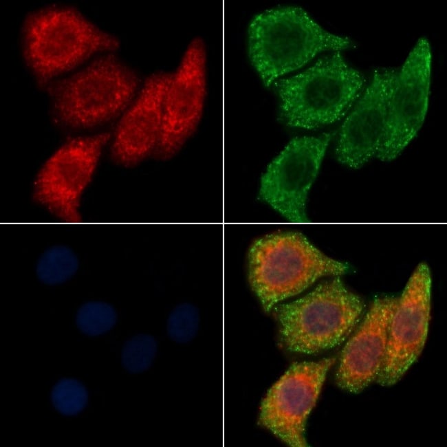 TMEM30A Polyclonal Antibody