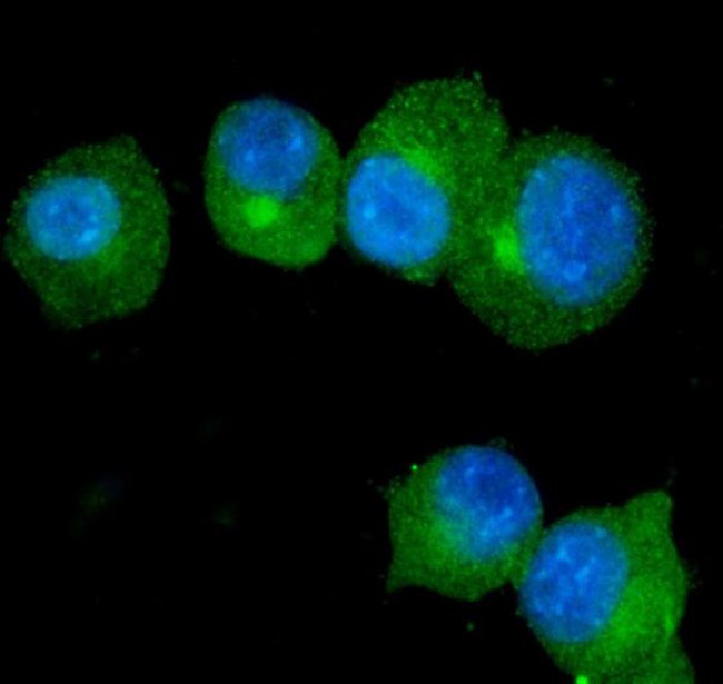 S100A9 Polyclonal Antibody