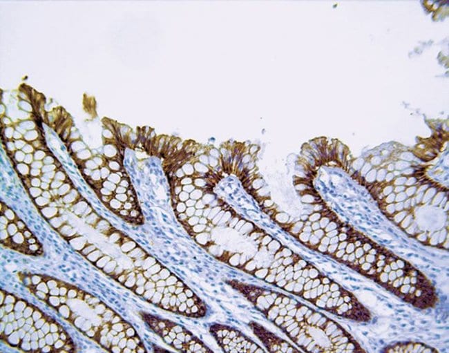 Claudin 3 Polyclonal Antibody
