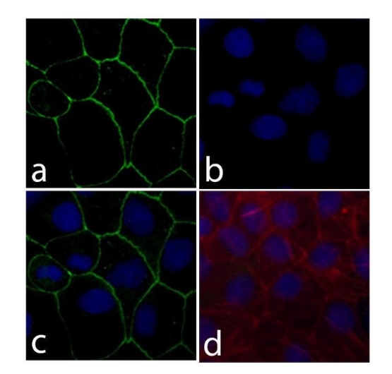 Claudin 18 Recombinant Rabbit Monoclonal Antibody (34H14L15)