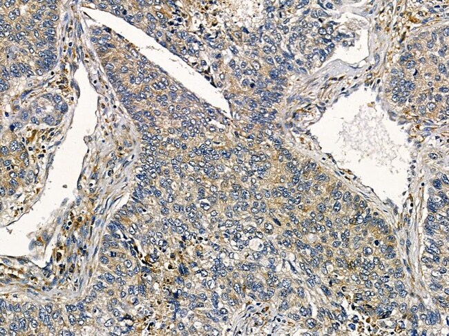 MFAP5 Polyclonal Antibody