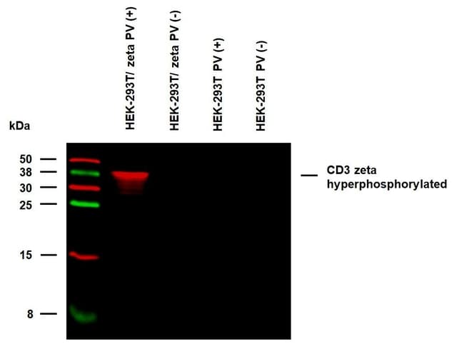 Phospho-CD247 (CD3 zeta) (Tyr153) Monoclonal Antibody (EM-17)