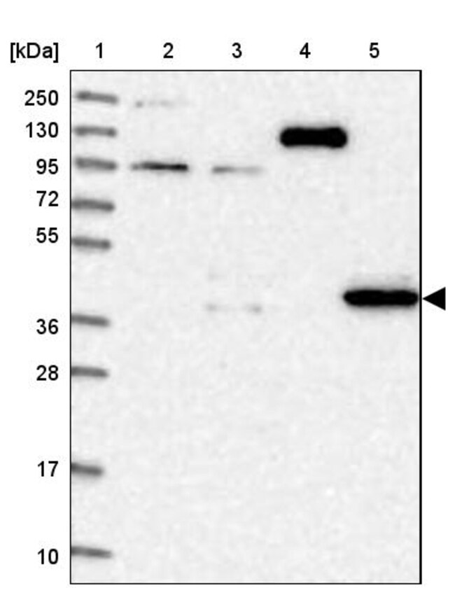 PDSS1 Polyclonal Antibody