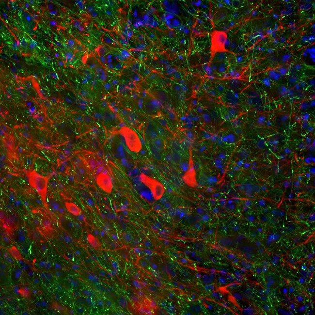 Tyrosine Hydroxylase Polyclonal Antibody