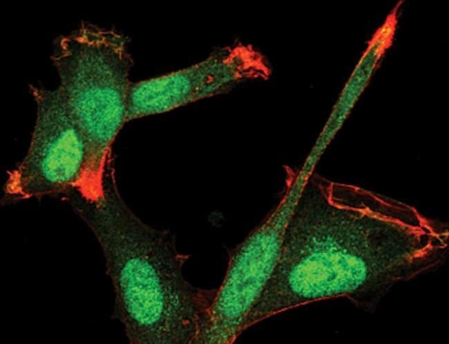 SMAD3 Monoclonal Antibody (E.980.9)