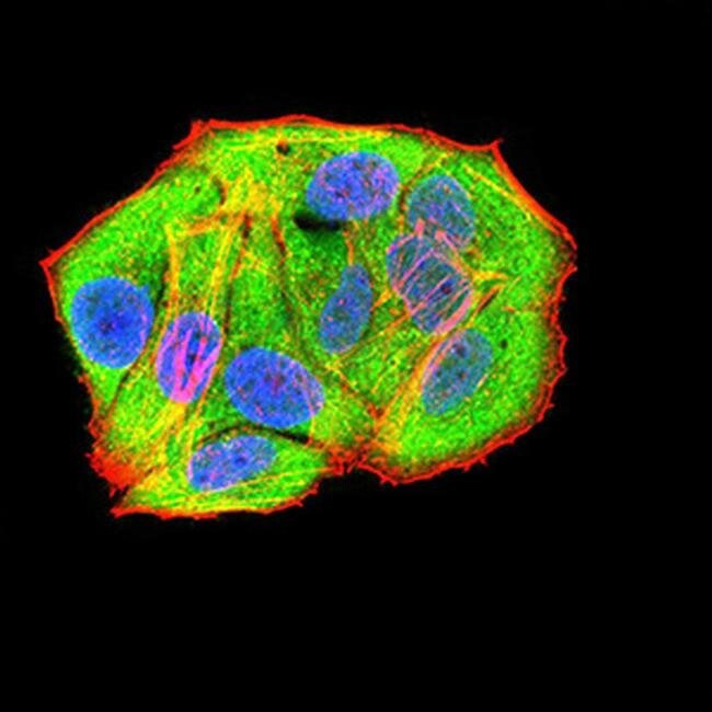 RAD21 Monoclonal Antibody (1B6D1)