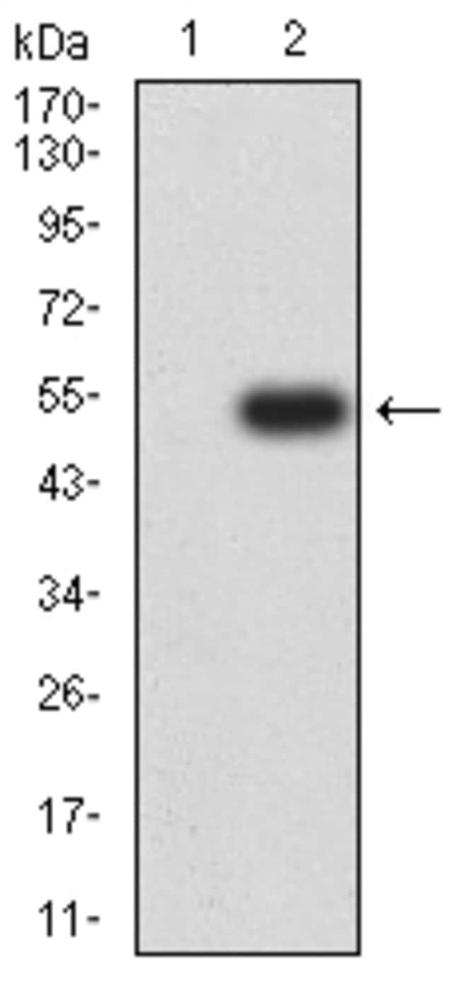 Claudin 6 Monoclonal Antibody (8G5D2)