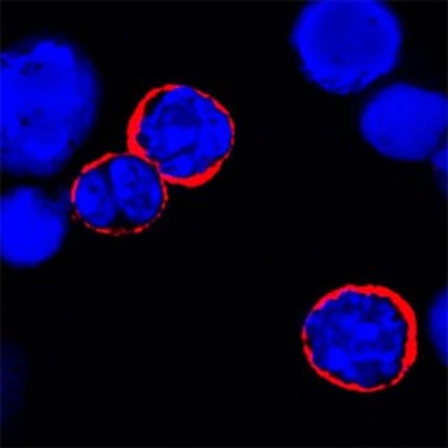 IL-6 Receptor Monoclonal Antibody (255820)