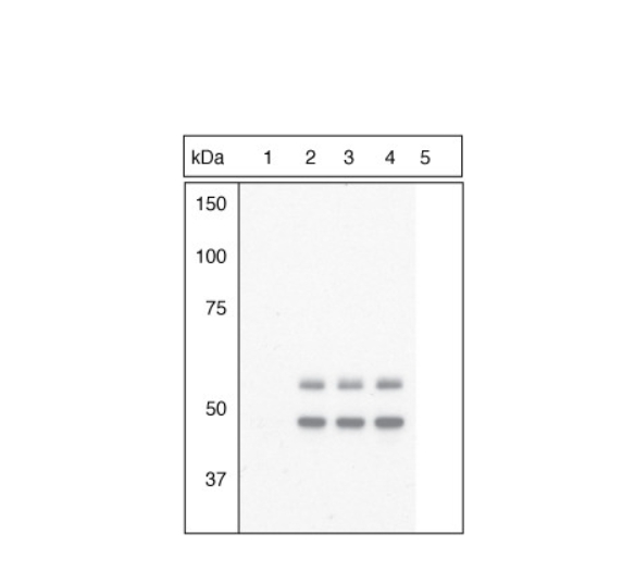 Phospho-GSK3B (Tyr216, Tyr279) Polyclonal Antibody