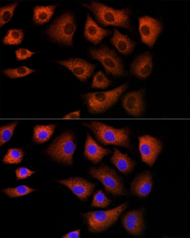 DBI Polyclonal Antibody