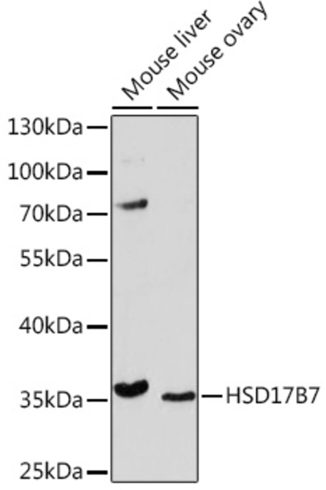HSD17B7 Polyclonal Antibody