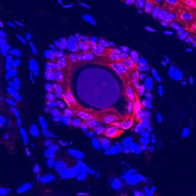 DARC Polyclonal Antibody